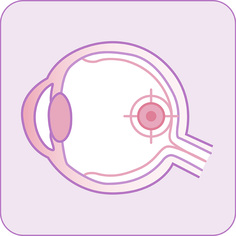 Macular Support